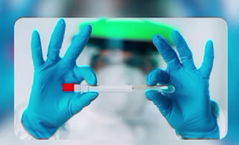 Molecular Lab Department